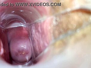 The climax in pussy with speculum